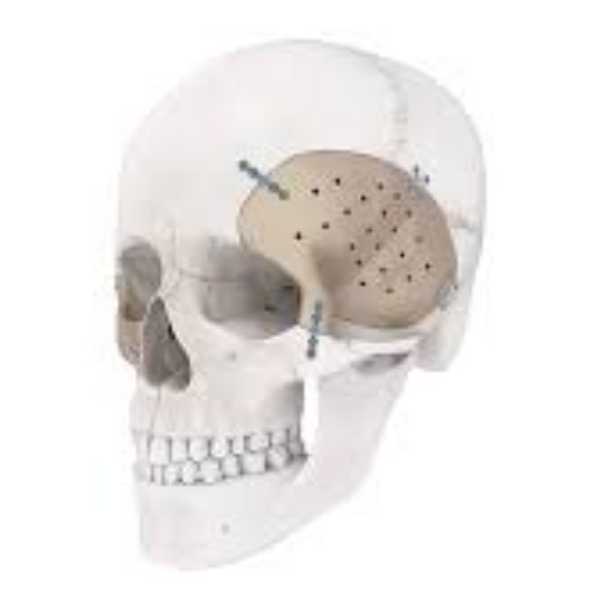 Peflon PEEK-Material